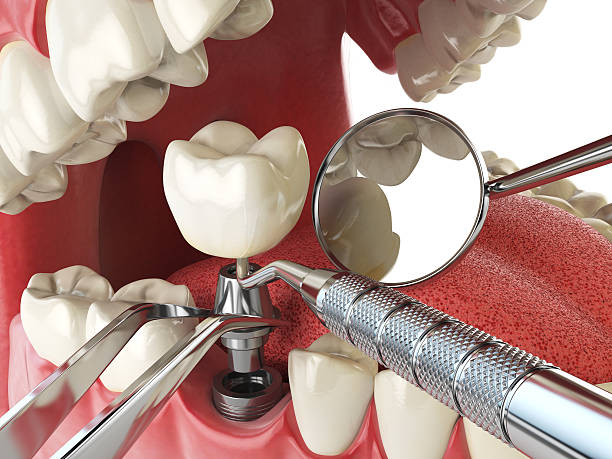Best Emergency Tooth Extraction  in Rosemount, MN